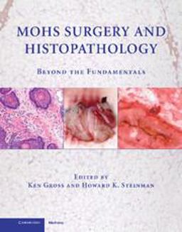 Mohs Surgery and Histopathology Beyond the Fundamentals  9780521888042 Front Cover