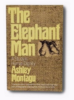 The Elephant Man