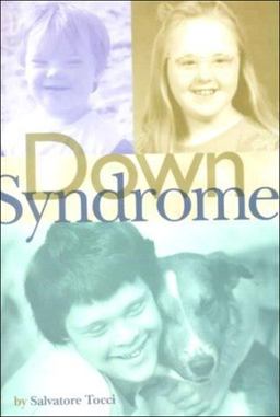 Down Syndrome