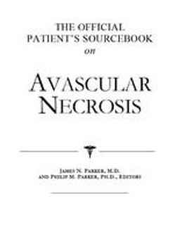 The Official Patient's Sourcebook on Avascular Necrosis
