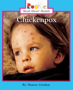 Chickenpox