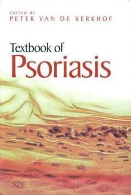 Textbook of Psoriasis  9780632051663 Front Cover