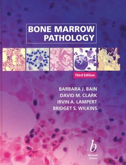 Bone Marrow Pathology Bone Marrow Pathology