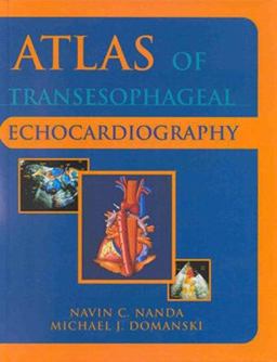 Atlas of Transesophageal Echocardiography  9780683063202 Front Cover