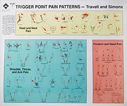 Travell and Simons' Trigger Point Pain Patterns Wall Charts  9780683083682 Front Cover