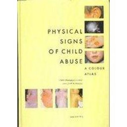 Physical Signs in Child Abuse