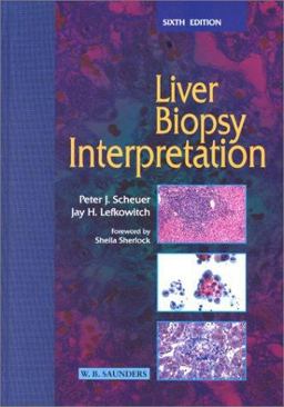 Liver Biopsy Interpretation 6th 9780702025020 Front Cover