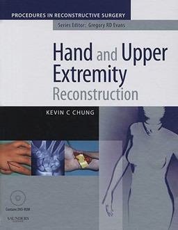 Hand and Upper Extremity Reconstruction