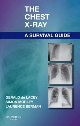 Chest X-Ray: a Survival Guide  9780702030468 Front Cover