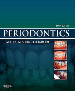 Periodontics 6th 9780702030659 Front Cover