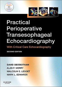 Practical Perioperative Transesophageal Echocardiography Text with DVD-ROM 2nd 9780702034275 Front Cover