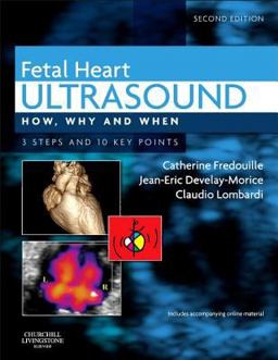 Fetal Heart Ultrasound How, Why and When 2nd 9780702043413 Front Cover