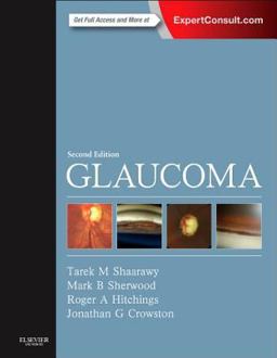 Glaucoma 2nd 9780702051937 Front Cover