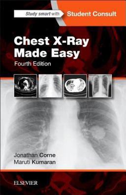 Chest X-Ray Made Easy 4th 9780702054990 Front Cover