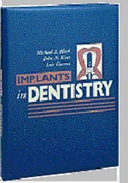 Implants in Dentistry