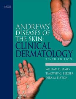 Andrews' Diseases of the Skin Clinical Dermatology 10th 9780721629216 Front Cover