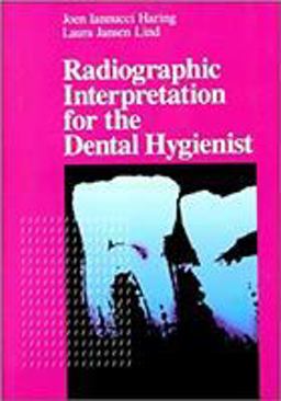 Radiographic Interpretation for the Dental Hygienist  9780721637044 Front Cover