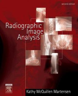 Radiographic Image Analysis 2nd 9780721639253 Front Cover