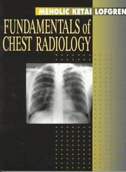 Fundamentals of Chest Radiology  9780721654003 Front Cover
