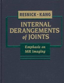 Internal Derangements of Joints Internal Derangements of Joints
