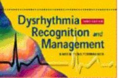 Dysrhythmia Recognition and Management 3rd 9780721679235 Front Cover
