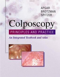 Colposcopy