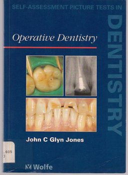 Operative Dentistry Self Assessment Pictures