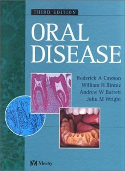 Oral Disease Oral Disease