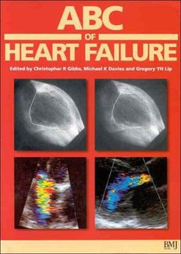 ABC of Heart Failure