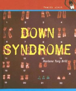 Down Syndrome Down Syndrome
