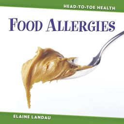 Food Allergies