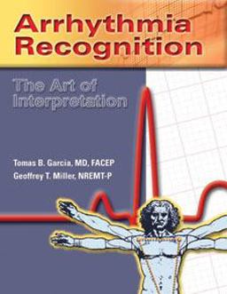 Arrhythmia Recognition: the Art of Interpretation  9780763722463 Front Cover