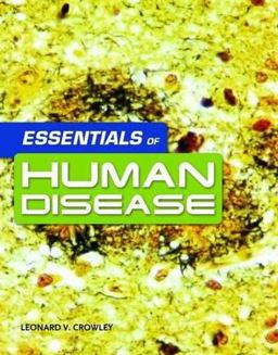 Essentials of Human Disease  9780763765903 Front Cover