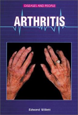 Arthritis