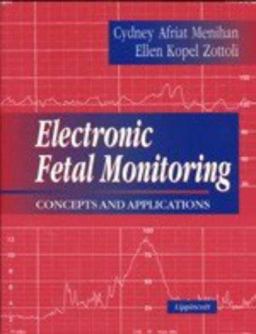 Electronic Fetal Monitoring Concepts and Applications  9780781726269 Front Cover