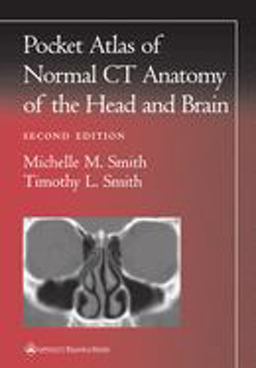 Pocket Atlas of Normal CT Anatomy of the Head and Brain 2nd 9780781729499 Front Cover