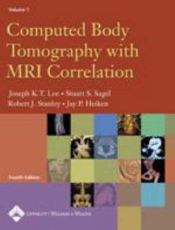 Computed Body Tomography with MRI Correlation 4th 9780781745260 Front Cover