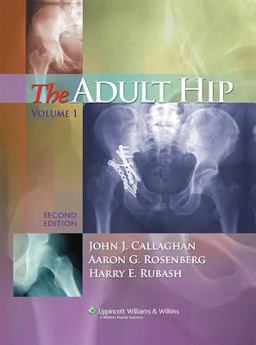 Adult Hip 2nd 9780781750929 Front Cover
