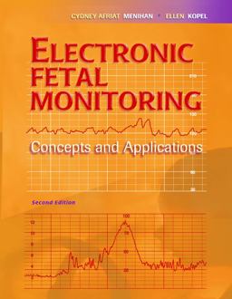 Electronic Fetal Monitoring Concepts and Applications 2nd 9780781770118 Front Cover