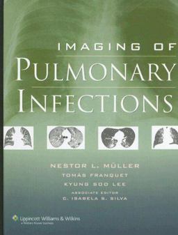 Imaging of Pulmonary Infections  9780781772327 Front Cover