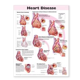 Heart Disease Anatomical Chart 2nd 9780781773379 Front Cover