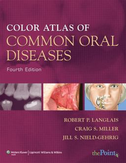 Color Atlas of Common Oral Diseases 4th 9780781780971 Front Cover