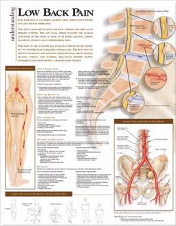 Understanding Low Back Pain Anatomical Chart  9780781782425 Front Cover
