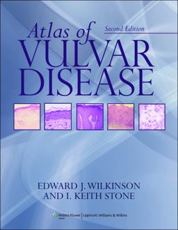 Atlas of Vulvar Disease 2nd 9780781789394 Front Cover