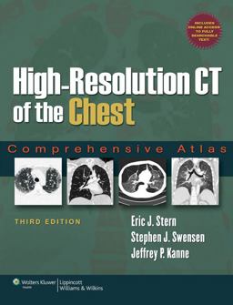High-Resolution CT of the Chest Comprehensive Atlas 3rd 9780781791908 Front Cover