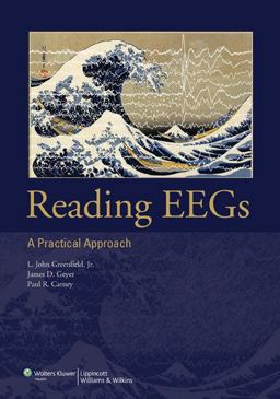 Reading EEGs: a Practical Approach Reading EEGs: a Practical Approach