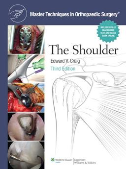 Shoulder 3rd 9780781797481 Front Cover