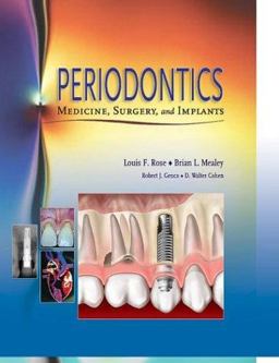 Periodontics Medicine, Surgery and Implants 2nd 9780801679780 Front Cover