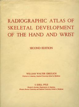 Radiographic Atlas of Skeletal Development of the Hand and Wrist 2nd 9780804703987 Front Cover