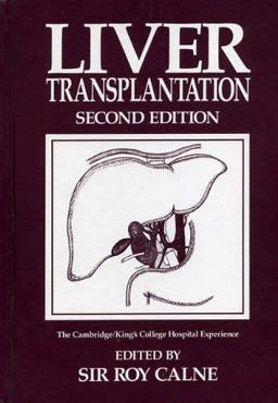 Liver Transplantation